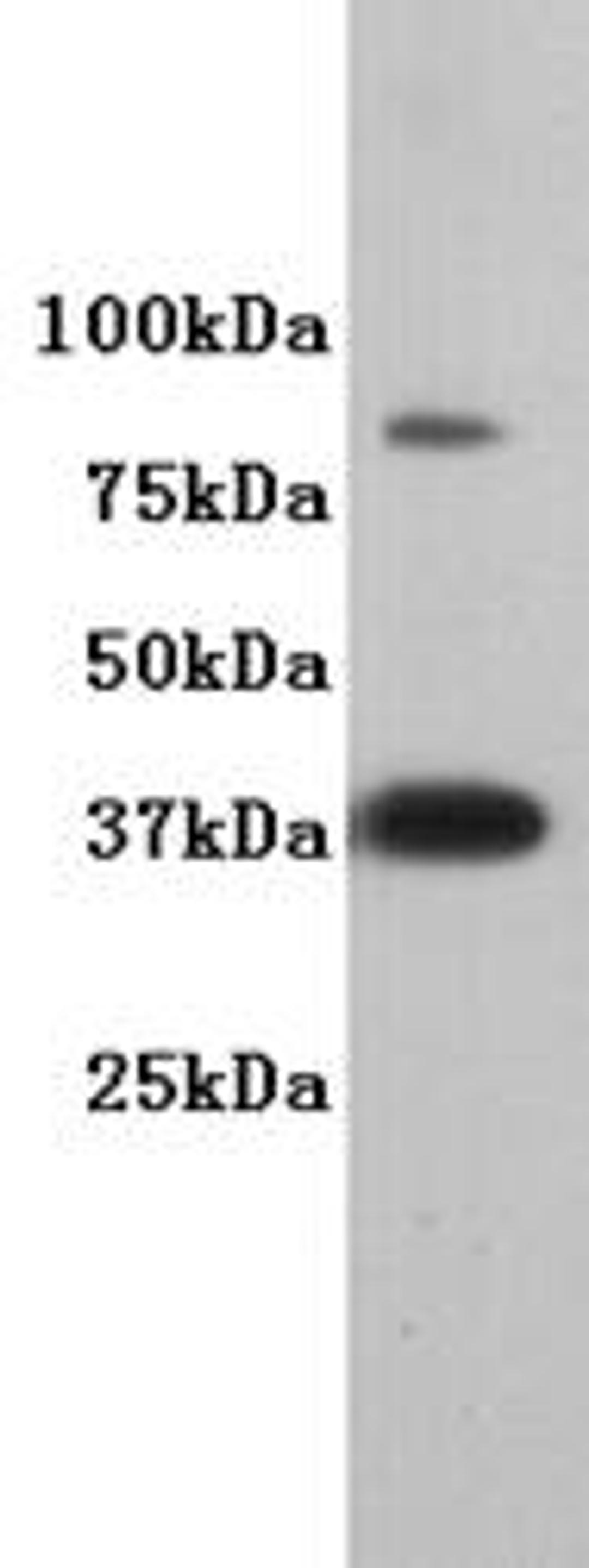 Western Blot analysis of F9 using DPPA2 antibody