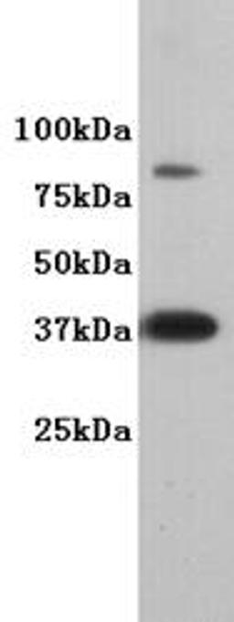 Western Blot analysis of F9 using DPPA2 antibody