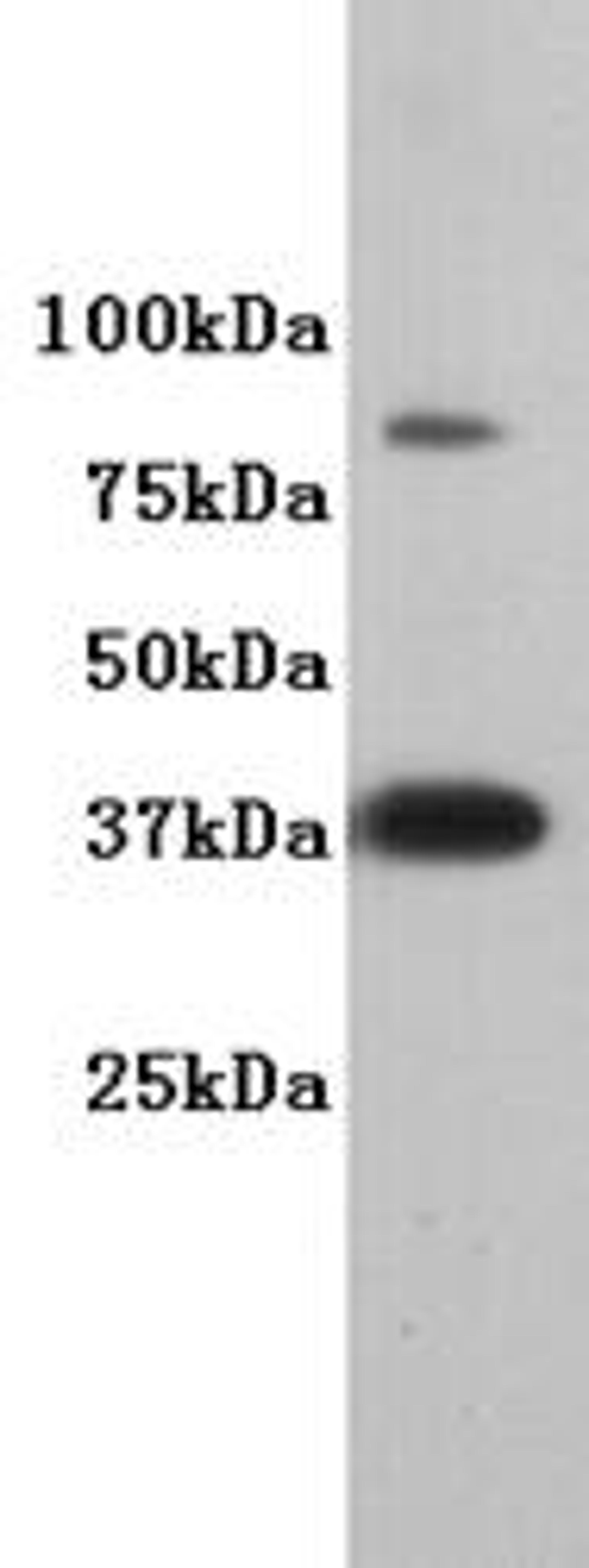 Western Blot analysis of F9 using DPPA2 antibody