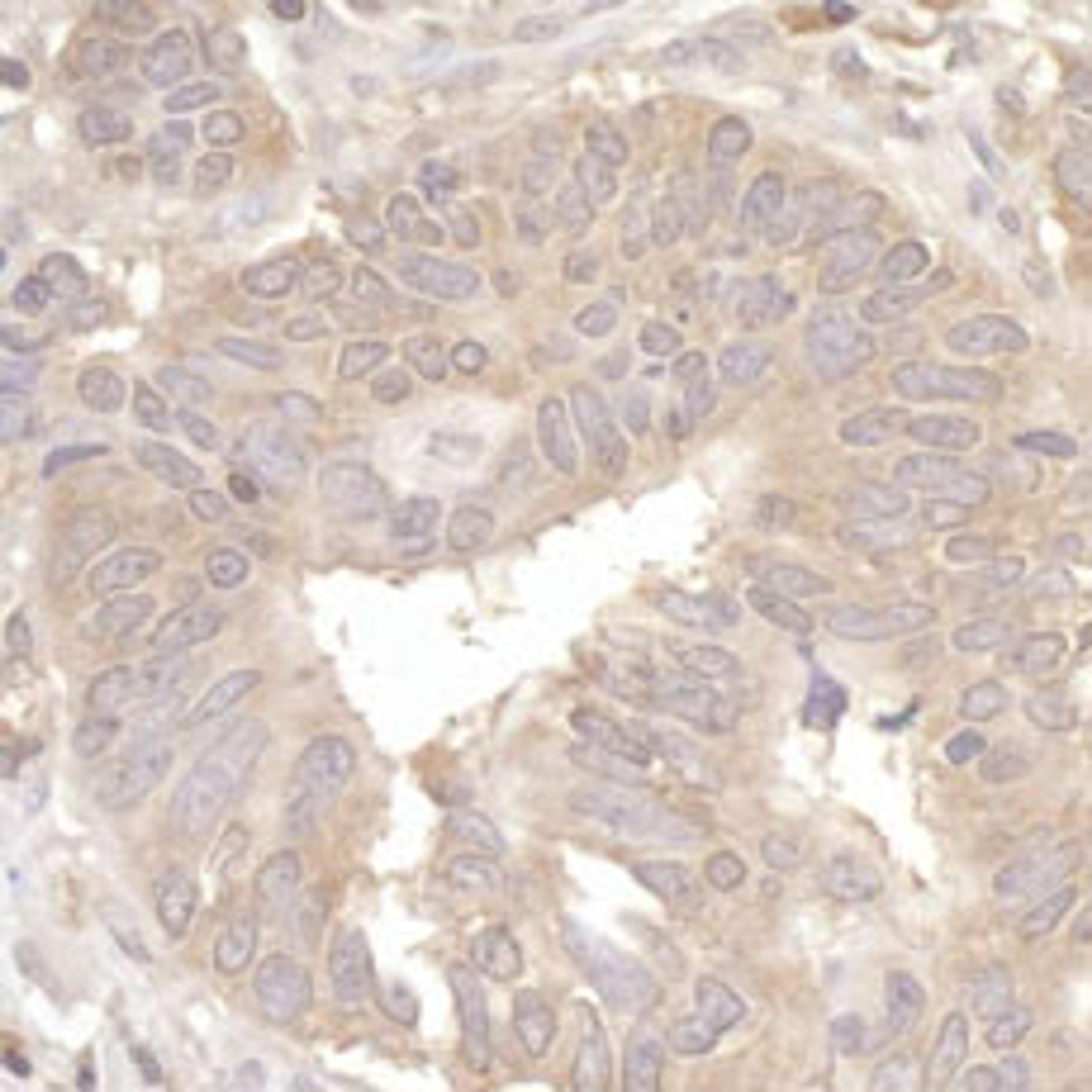 Detection of human eIF2A by immunohistochemistry.