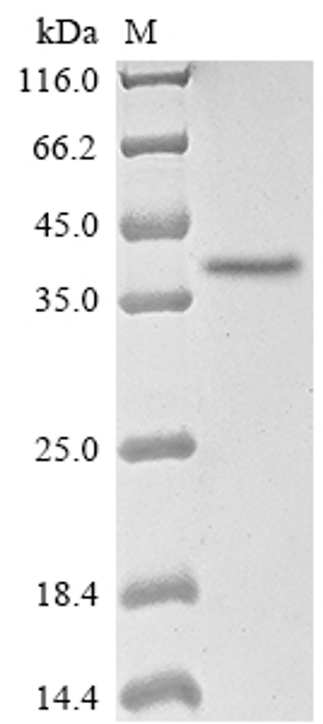 (Tris-Glycine gel) Discontinuous SDS-PAGE (reduced) with 5% enrichment gel and 15% separation gel.