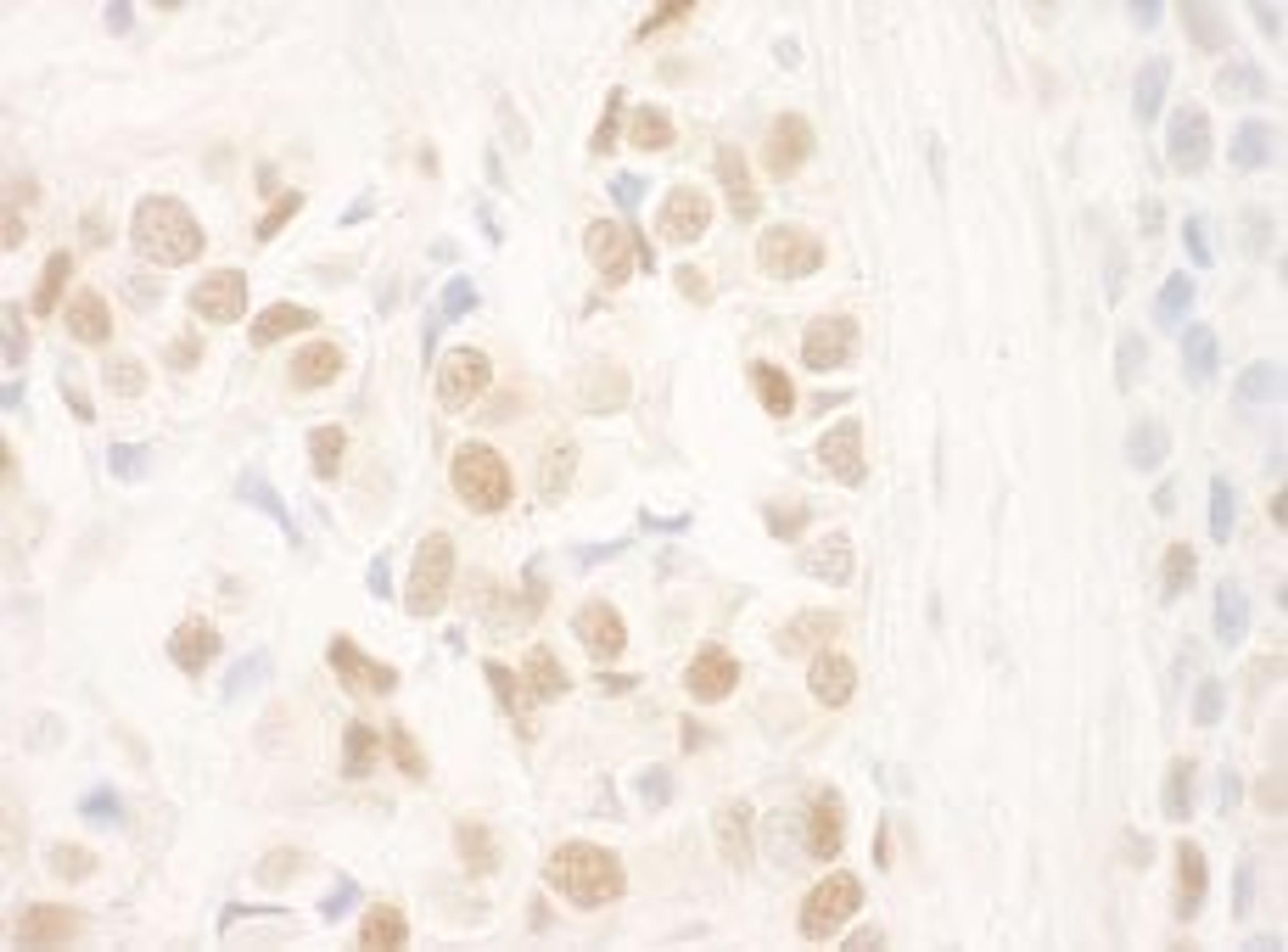 Detection of human NRIP by immunohistochemistry.