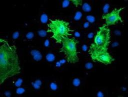 Immunocytochemistry/Immunofluorescence: Calponin 2 Antibody (2B5) [NBP2-01325] - Staining of COS7 cells transiently transfected by pCMV6-ENTRY Calponin 2.