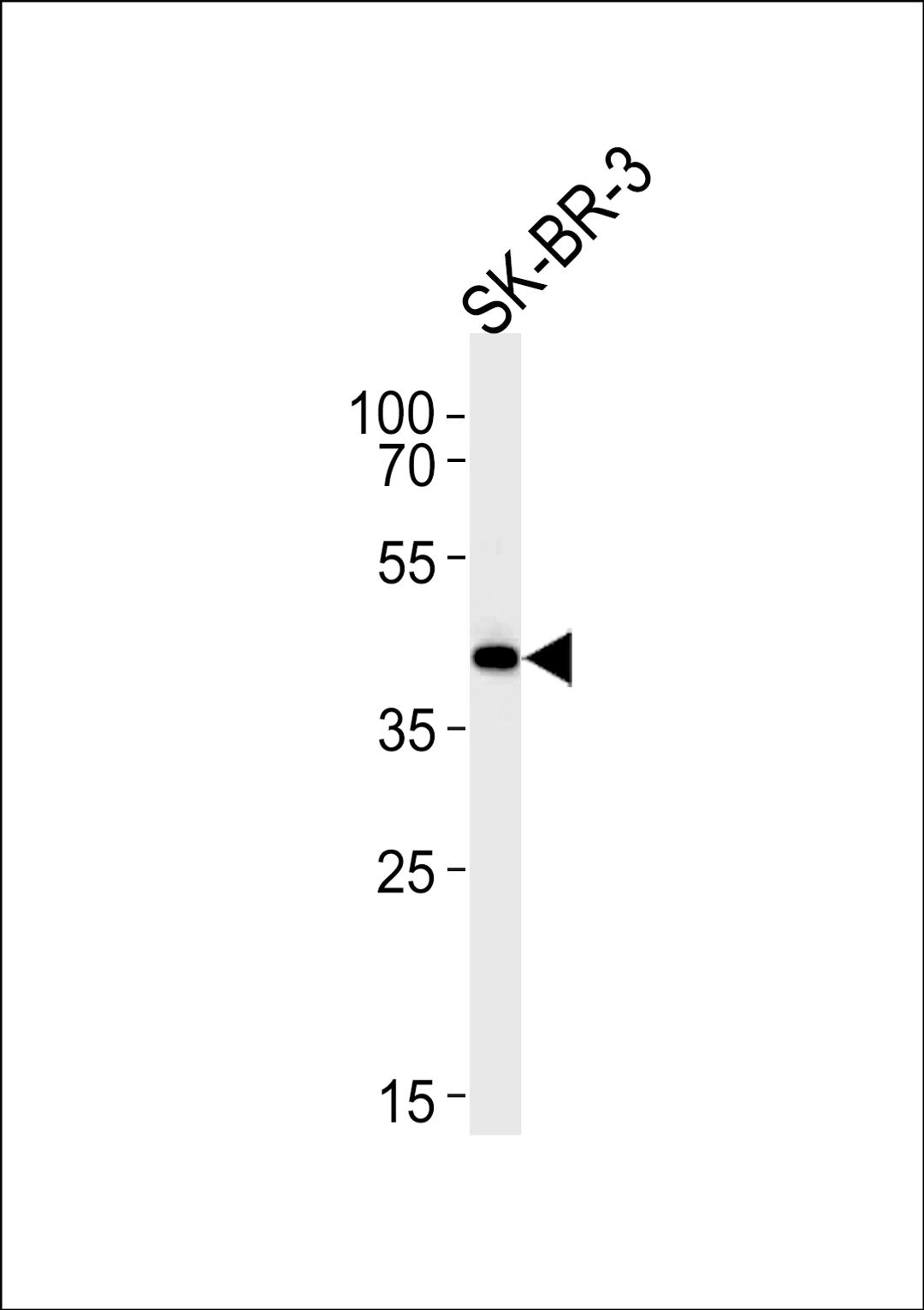 Western blot analysis in SK-BR-3 cell line lysates (35ug/lane).