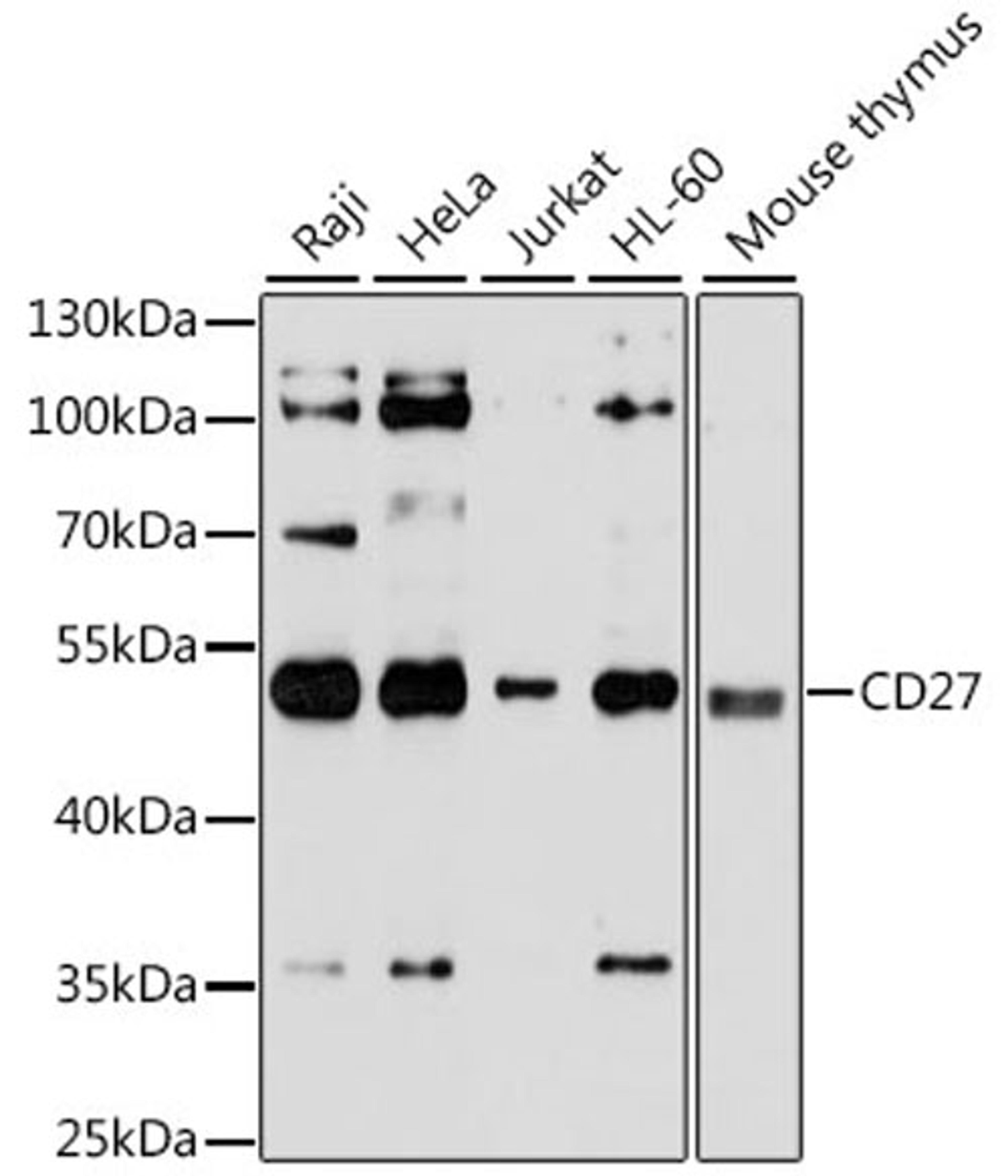 Western blot - CD27 antibody (A1945)