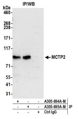 Detection of human MCTP2 by WB of IP.