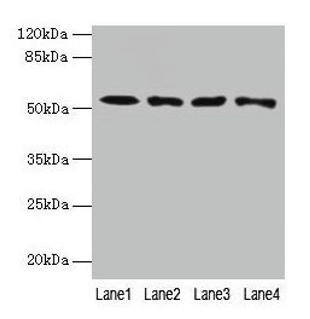 Western blot. All lanes: CAP2 antibody at 4µg/ml. Lane 1: HepG2 whole cell lysate. Lane 2: Mouse muscle tissue. Lane 3: Mouse gonadal tissue. Lane 4: Hela whole cell lysate. Secondary. Goat polyclonal to rabbit IgG at 1/10000 dilution. Predicted band size: 53, 46, 25 kDa. Observed band size: 53 kDa