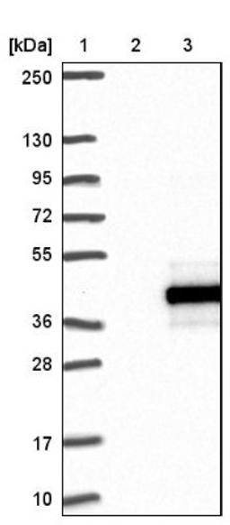 Western Blot: RPUSD1 Antibody [NBP1-88448] - Lane 1: Marker [kDa] 250, 130, 95, 72, 55, 36, 28, 17, 10<br/>Lane 2: Negative control (vector only transfected HEK293T lysate)<br/>Lane 3: Over-expression lysate (Co-expressed with a C-terminal myc-DDK tag (~3.1 kDa) in mammalian HEK293T cells, LY409228)