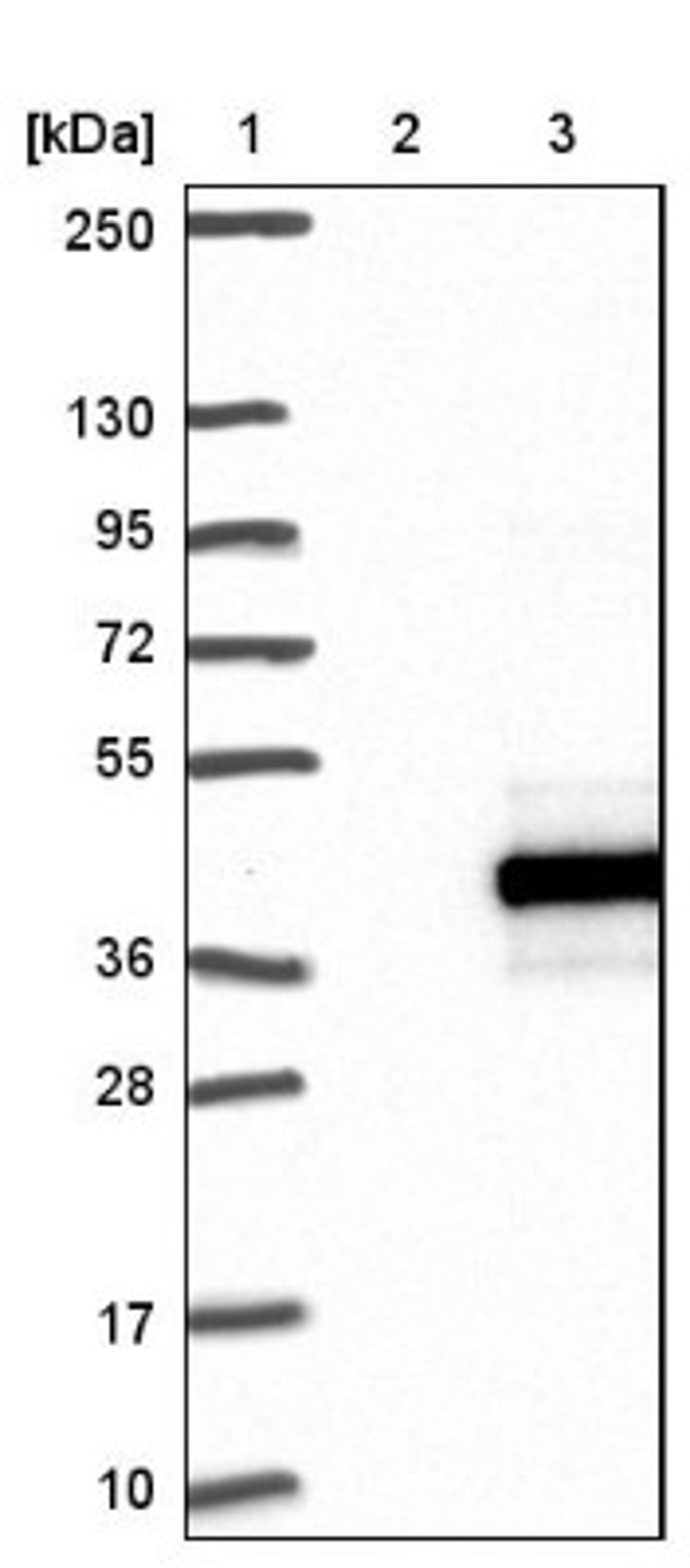 Western Blot: RPUSD1 Antibody [NBP1-88448] - Lane 1: Marker [kDa] 250, 130, 95, 72, 55, 36, 28, 17, 10<br/>Lane 2: Negative control (vector only transfected HEK293T lysate)<br/>Lane 3: Over-expression lysate (Co-expressed with a C-terminal myc-DDK tag (~3.1 kDa) in mammalian HEK293T cells, LY409228)