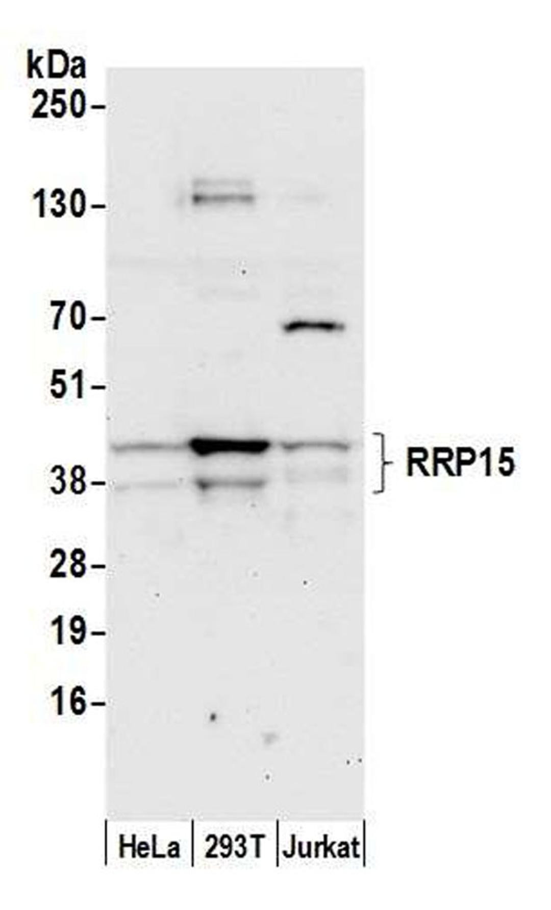 Detection of human RRP15 by WB.