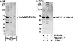 Detection of human MARVELD2/Tricellulin by WB and IP.