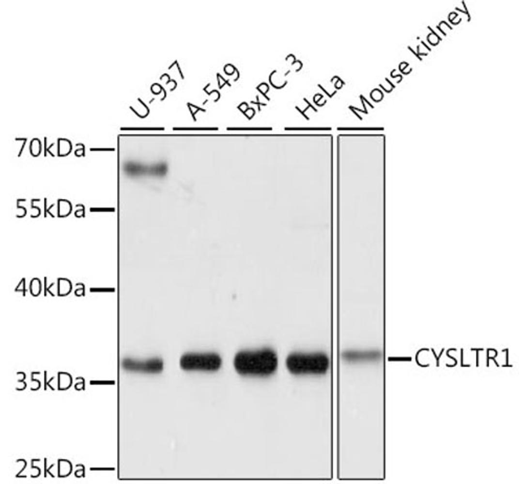 Western blot - CYSLTR1 antibody (A1815)