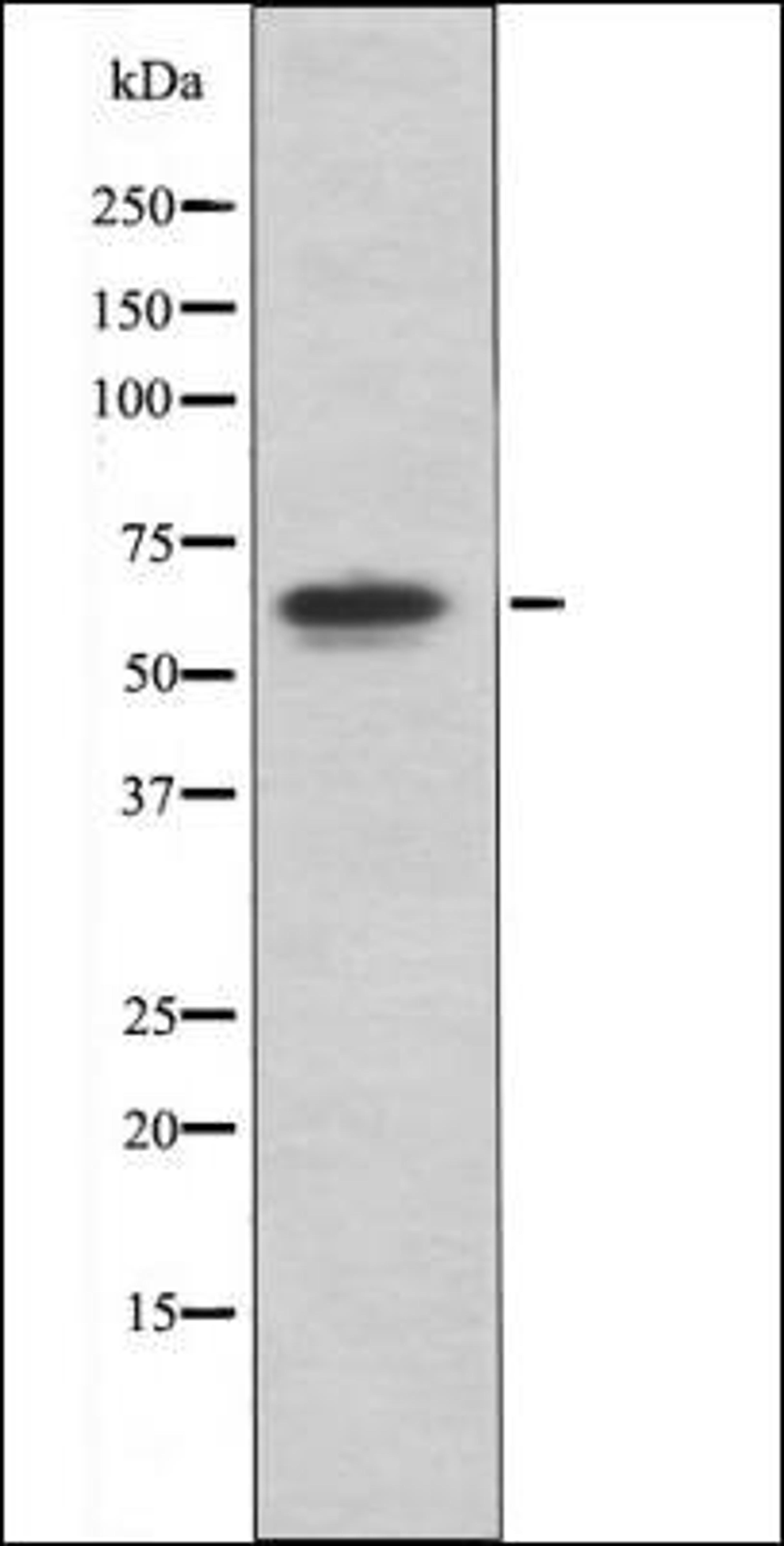 Western blot analysis of TNF treated HeLa whole cell lysates using PAK4/5/6 -Phospho-Ser474- antibody