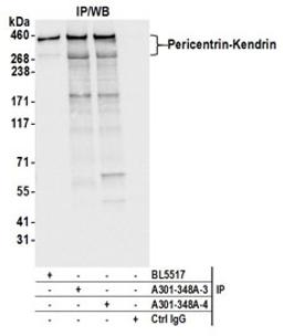 Detection of human Pericentrin-Kendrin by western blot of immunoprecipitates.