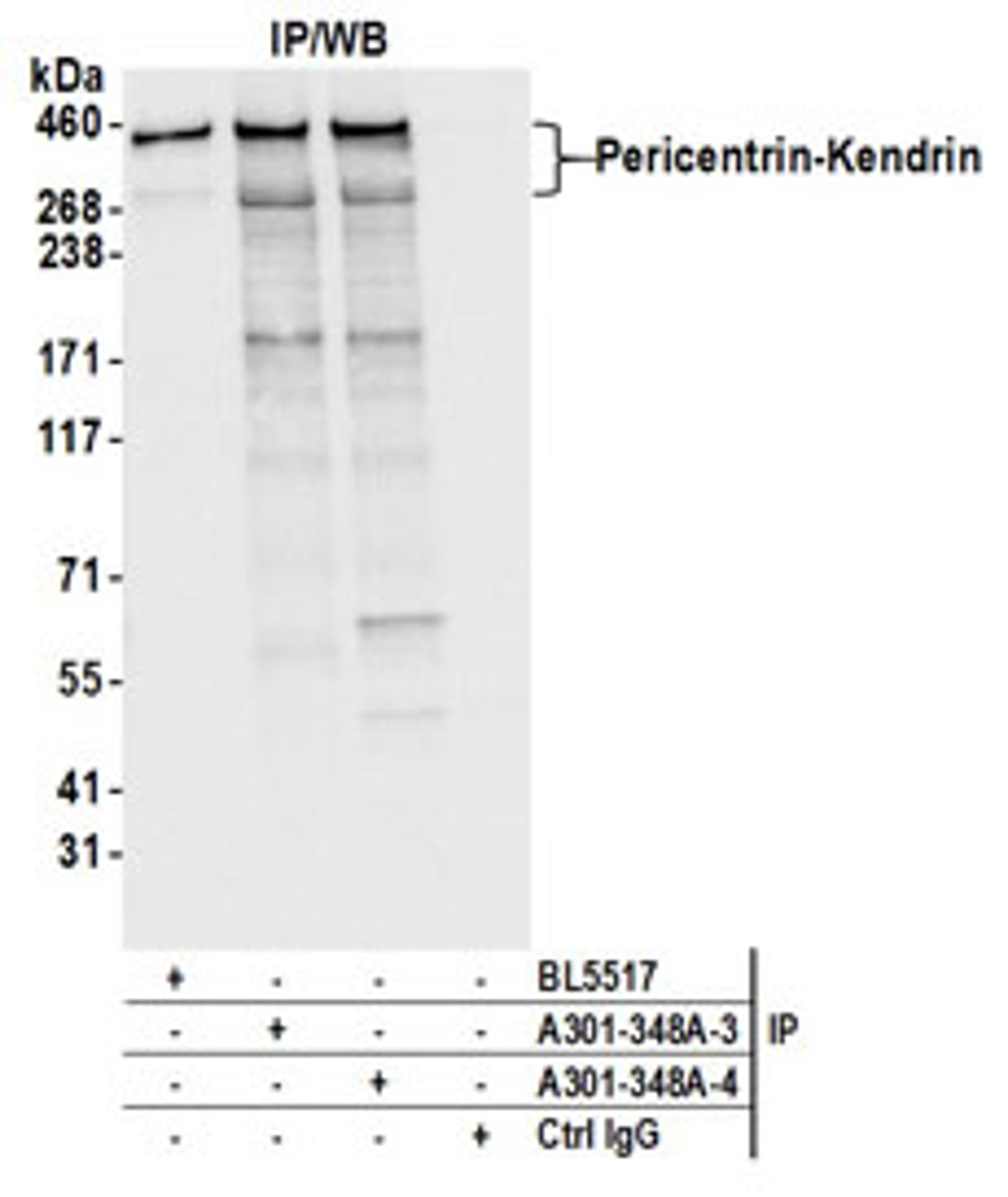 Detection of human Pericentrin-Kendrin by western blot of immunoprecipitates.