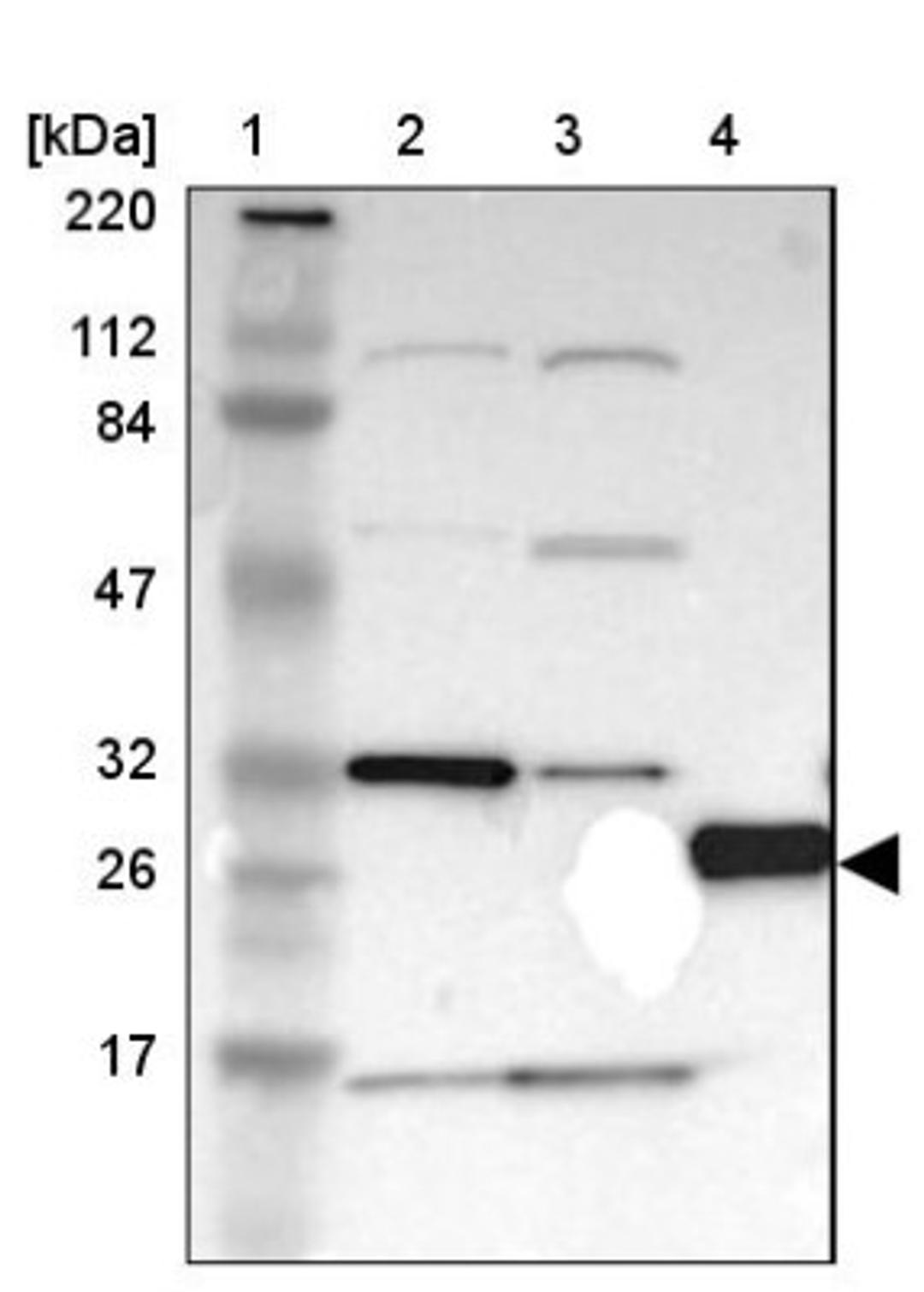 Western Blot: PX19 Antibody [NBP1-88093] - Lane 1: Marker [kDa] 220, 112, 84, 47, 32, 26, 17<br/>Lane 2: Human cell line RT-4<br/>Lane 3: Human cell line U-251MG sp<br/>Lane 4: Human plasma (IgG/HSA depleted)