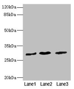 Western blot. All lanes: RCHY1 antibody at 3.98µg/ml. Lane 1: SH-SY5Y whole cell lysate. Lane 2: 293T whole cell lysate. Lane 3: Hela whole cell lysate. Secondary. Goat polyclonal to rabbit IgG at 1/10000 dilution. Predicted band size: 31, 29, 21, 22, 9, 28, 26, 25 kDa. Observed band size: 31 kDa