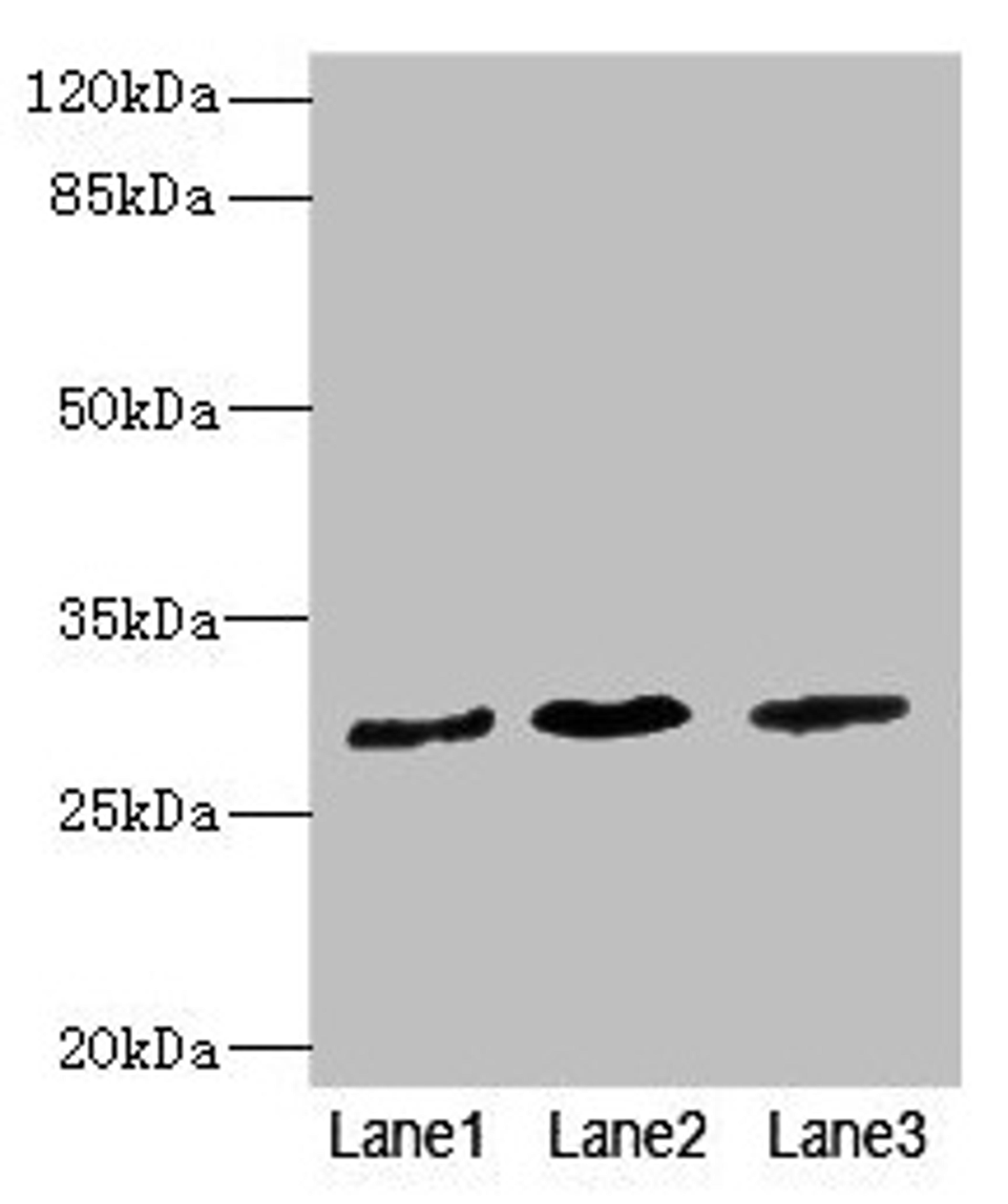Western blot. All lanes: RCHY1 antibody at 3.98µg/ml. Lane 1: SH-SY5Y whole cell lysate. Lane 2: 293T whole cell lysate. Lane 3: Hela whole cell lysate. Secondary. Goat polyclonal to rabbit IgG at 1/10000 dilution. Predicted band size: 31, 29, 21, 22, 9, 28, 26, 25 kDa. Observed band size: 31 kDa