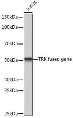 Western blot - TRK fused gene Rabbit mAb (A1534)