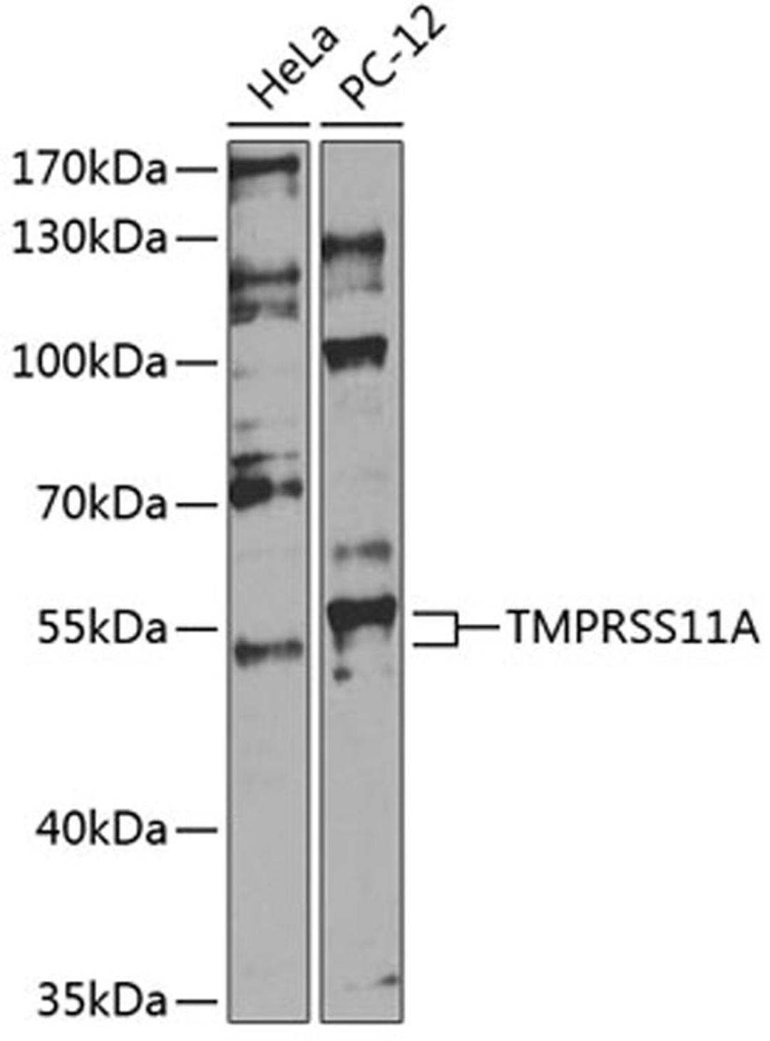 Western blot - TMPRSS11A antibody (A14167)