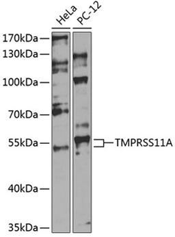 Western blot - TMPRSS11A antibody (A14167)