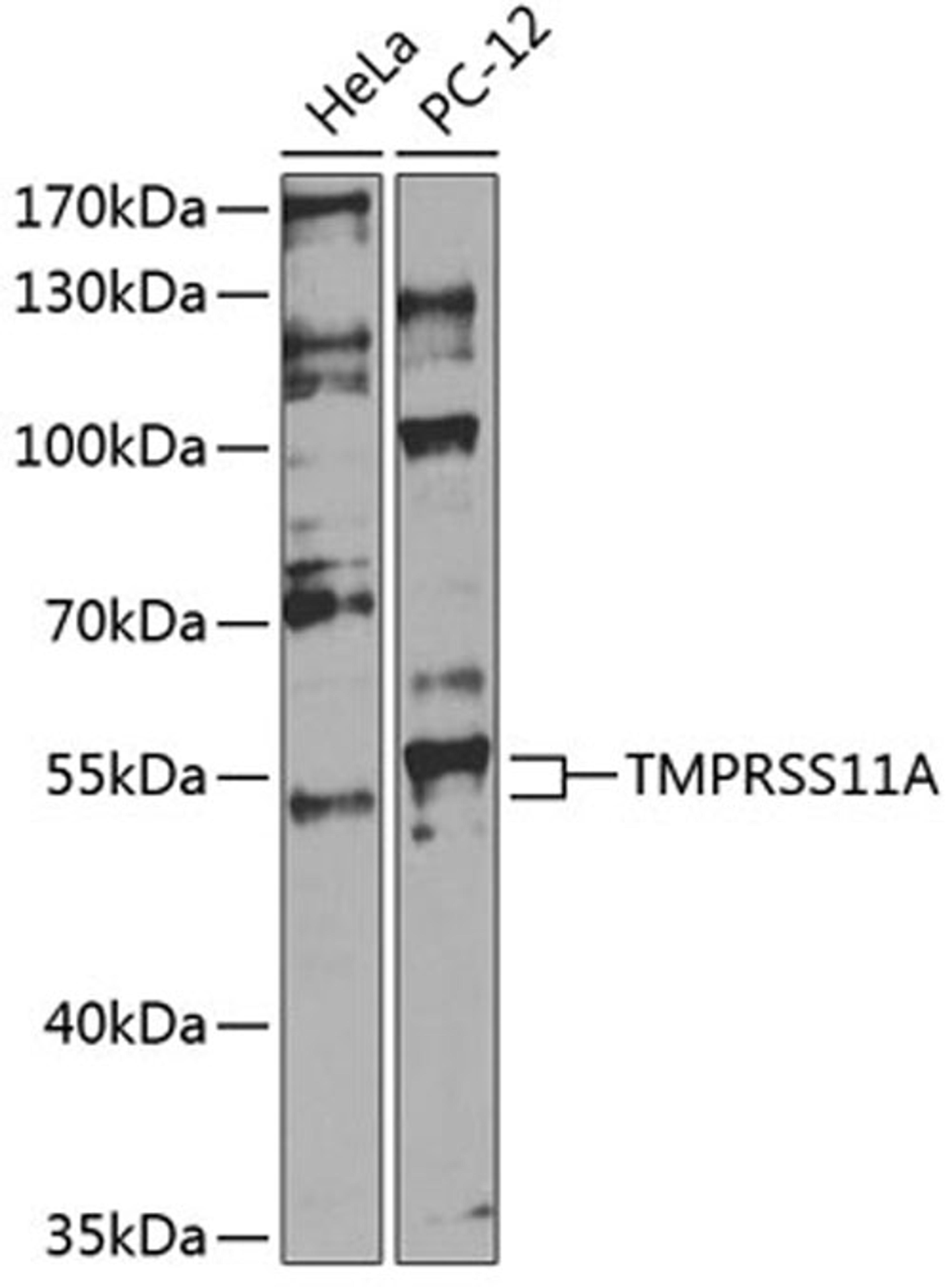 Western blot - TMPRSS11A antibody (A14167)