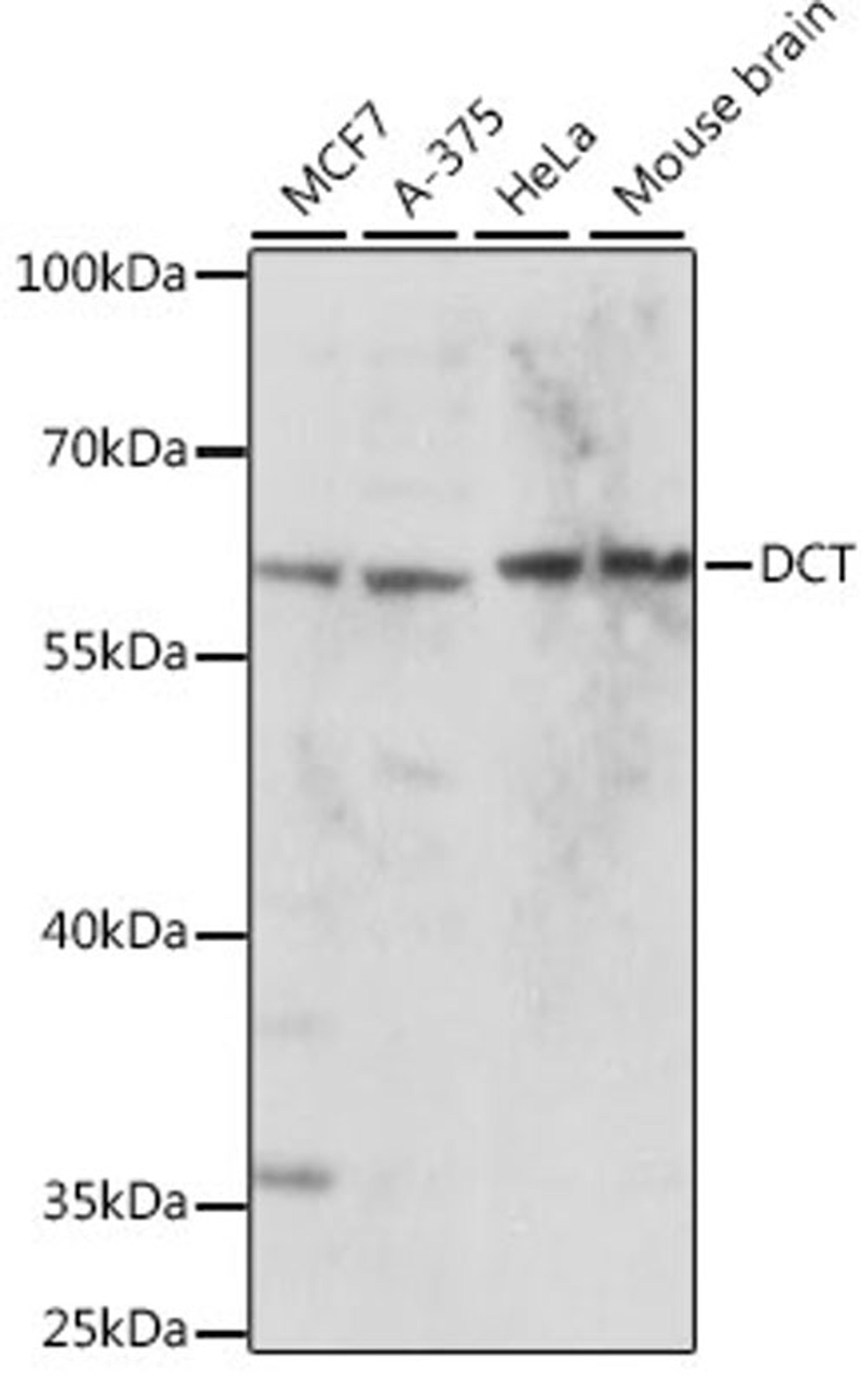 Western blot - DCT antibody (A16041)