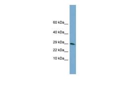 Antibody used in WB on Human Brain at 1 ug/ml.