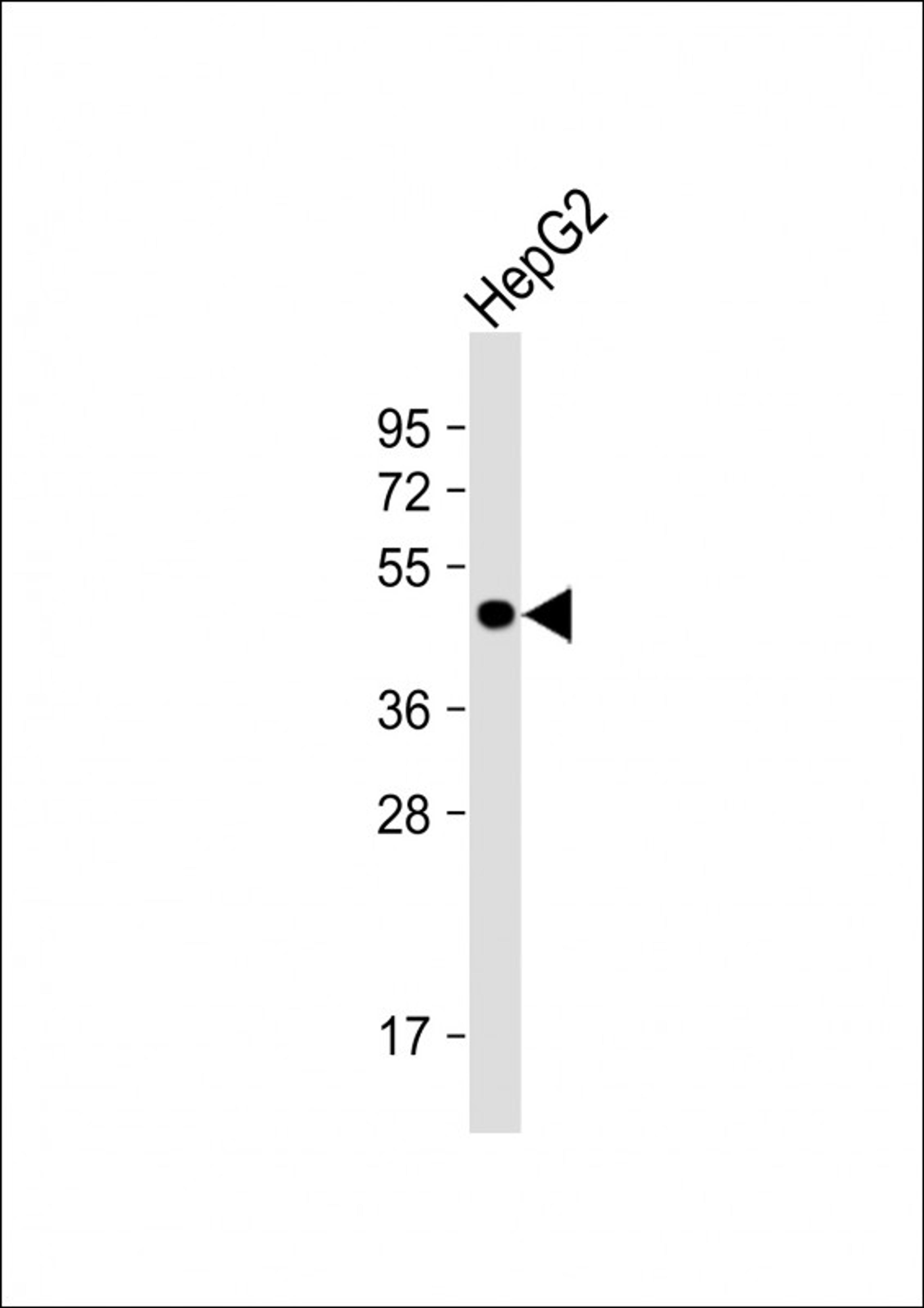 Western Blot at 1:1000 dilution + HepG2 whole cell lysate Lysates/proteins at 20 ug per lane.