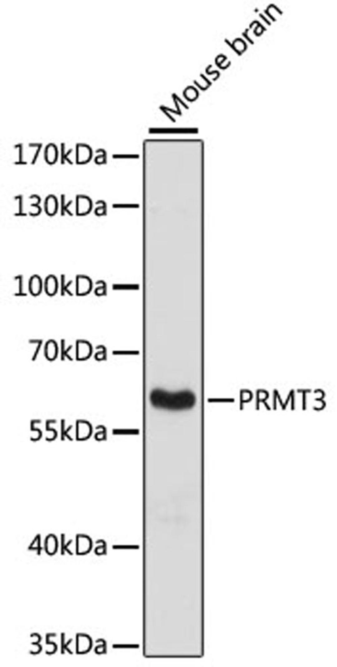 Western blot - PRMT3 antibody (A13068)