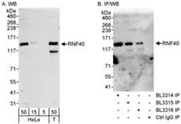 Detection of human RNF40 by western blot and immunoprecipitation.