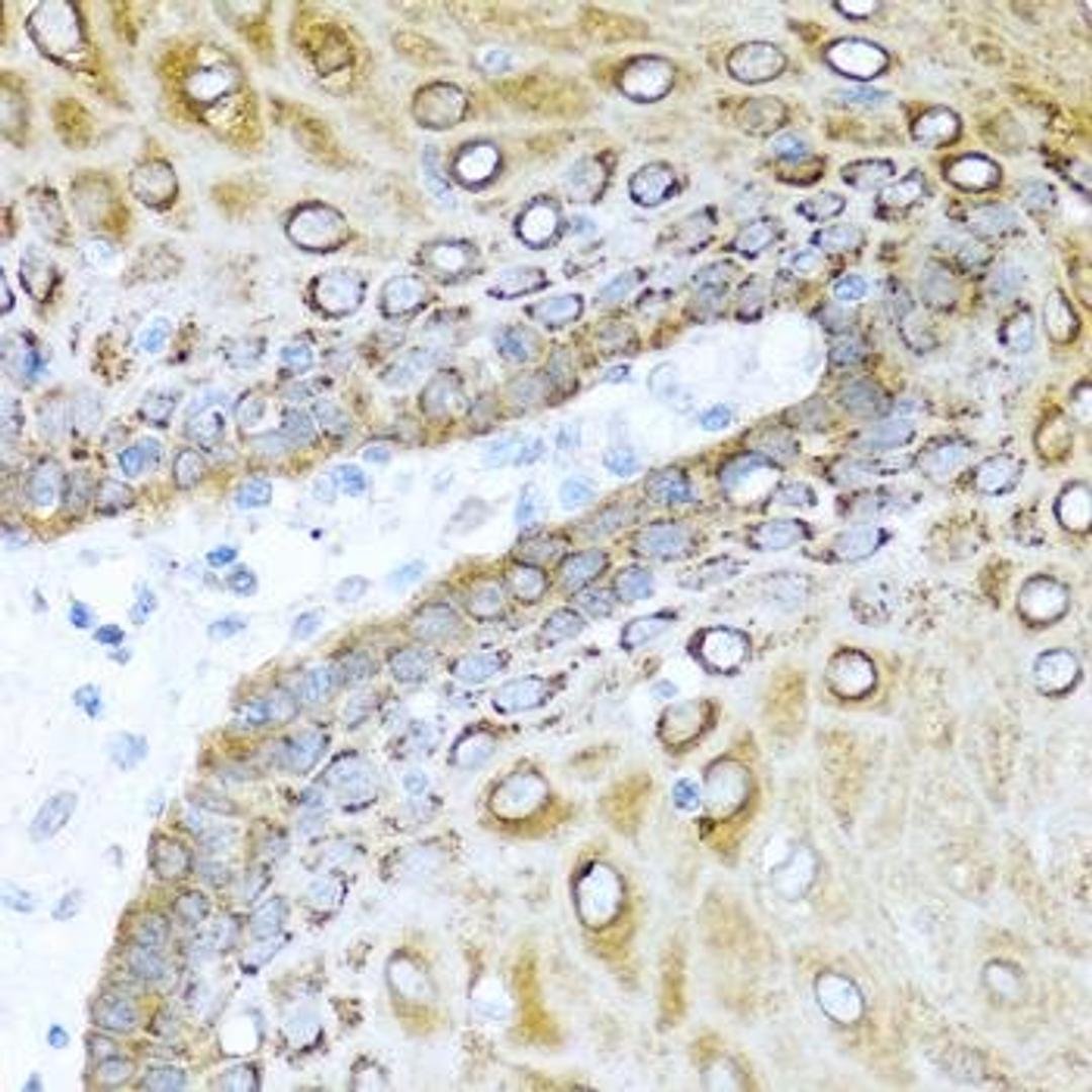 Immunohistochemical staining of rat lung tissue using S100A7 antibody (dilution of 1:100)