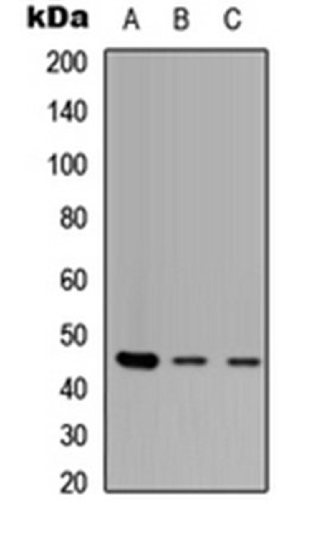 Western blot analysis of HEK293T (Lane 1), NS-1 (Lane 2), H9C2 (Lane 3) whole cell lysates using ZNF232 antibody