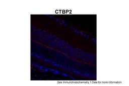 Antibody used in IHC on Mouse retina at 1:200.