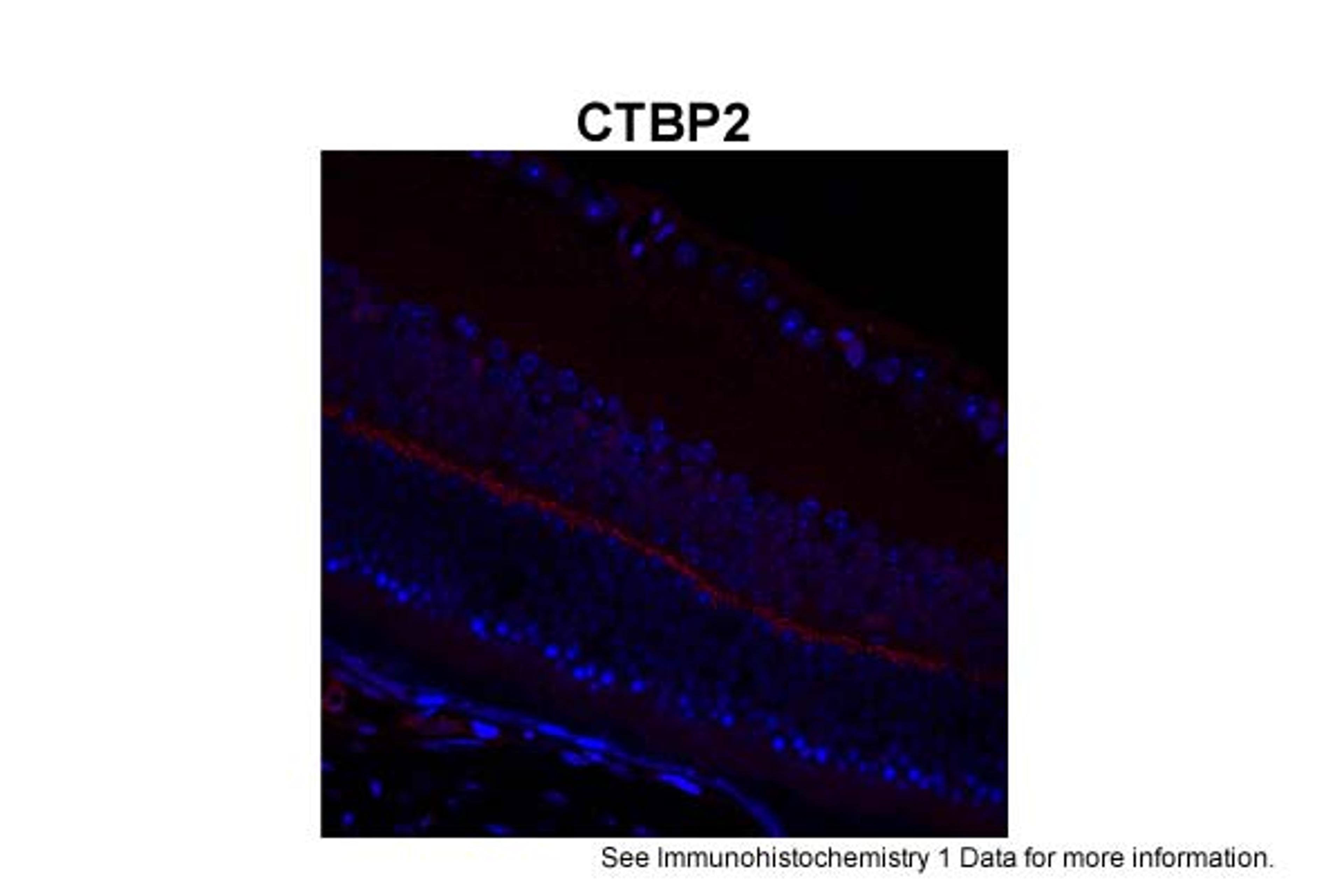 Antibody used in IHC on Mouse retina at 1:200.