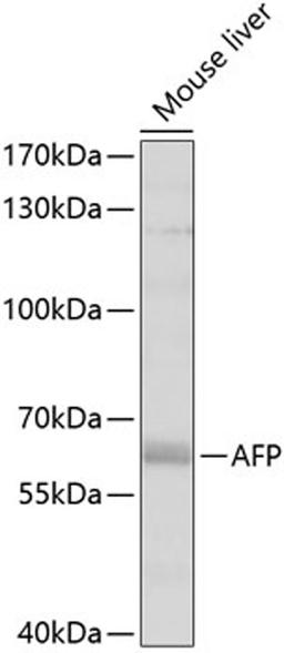 Western blot - AFP antibody (A11013)