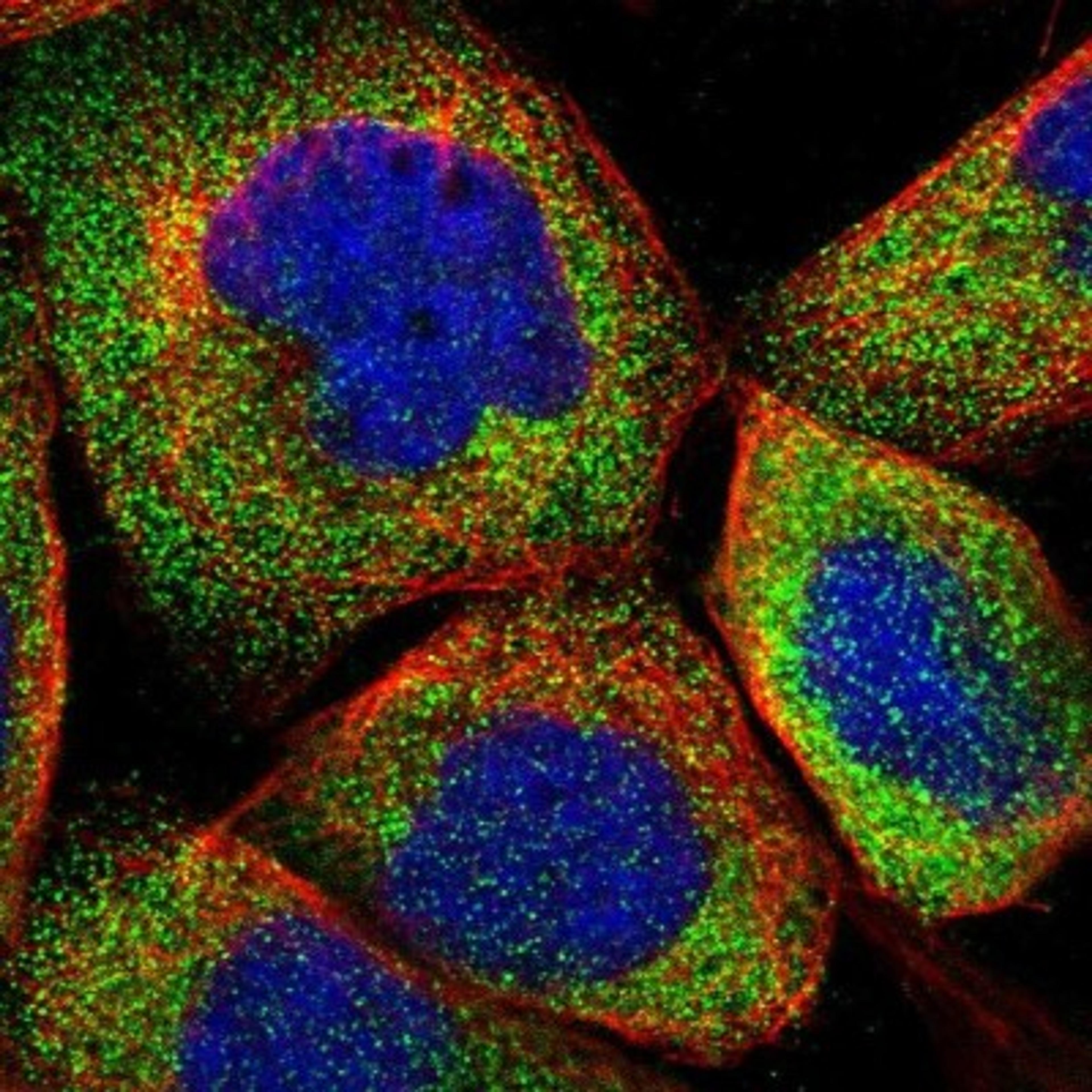 Immunocytochemistry/Immunofluorescence: C9orf43 Antibody [NBP1-82743] - Staining of human cell line A-431 shows positivity in cytoplasm.