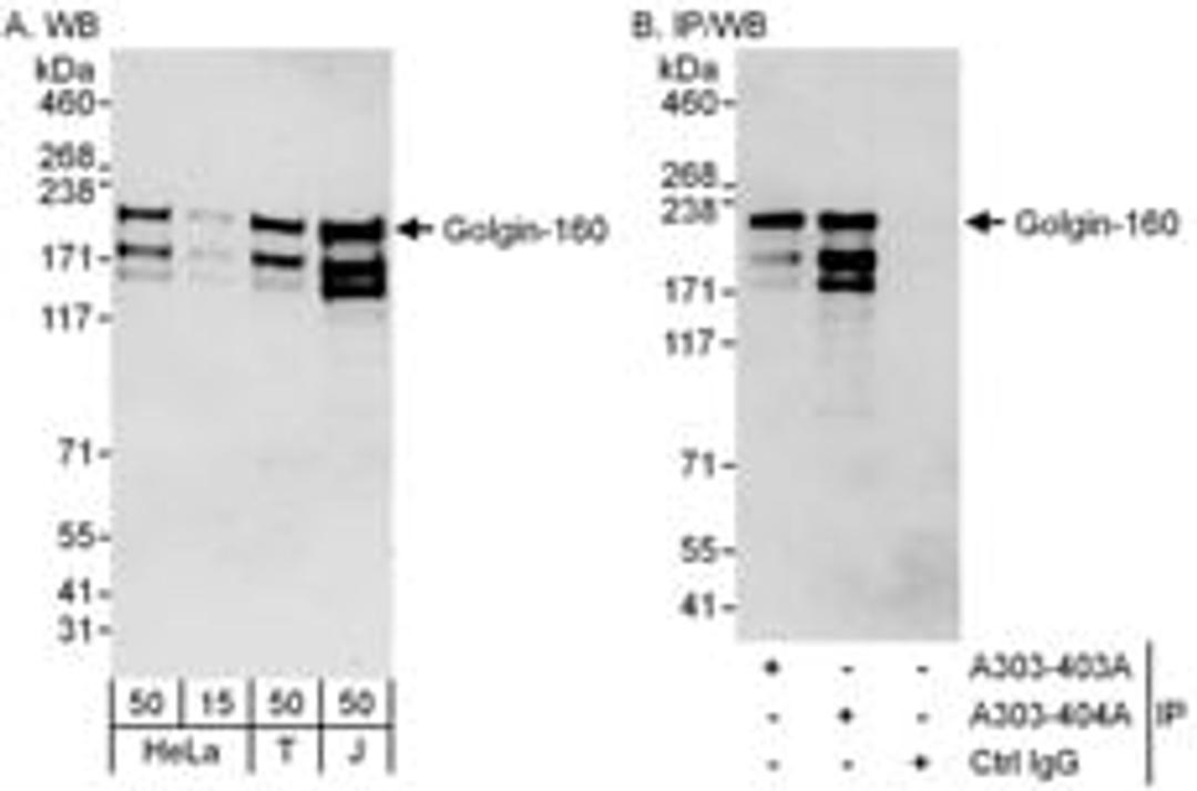 Detection of human Golgin-160 by western blot and immunoprecipitation.