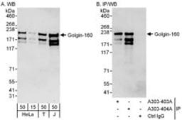 Detection of human Golgin-160 by western blot and immunoprecipitation.