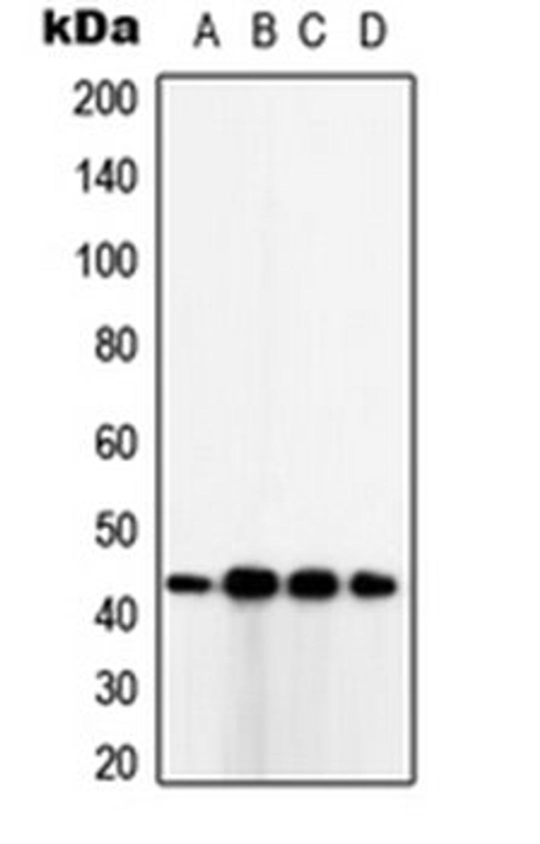 Western blot analysis of SKBR3 (Lane 1), HeLa (Lane 2), HepG2 (Lane 3), MDAMB231 (Lane 4) whole cell lysates using TUSC3 antibody