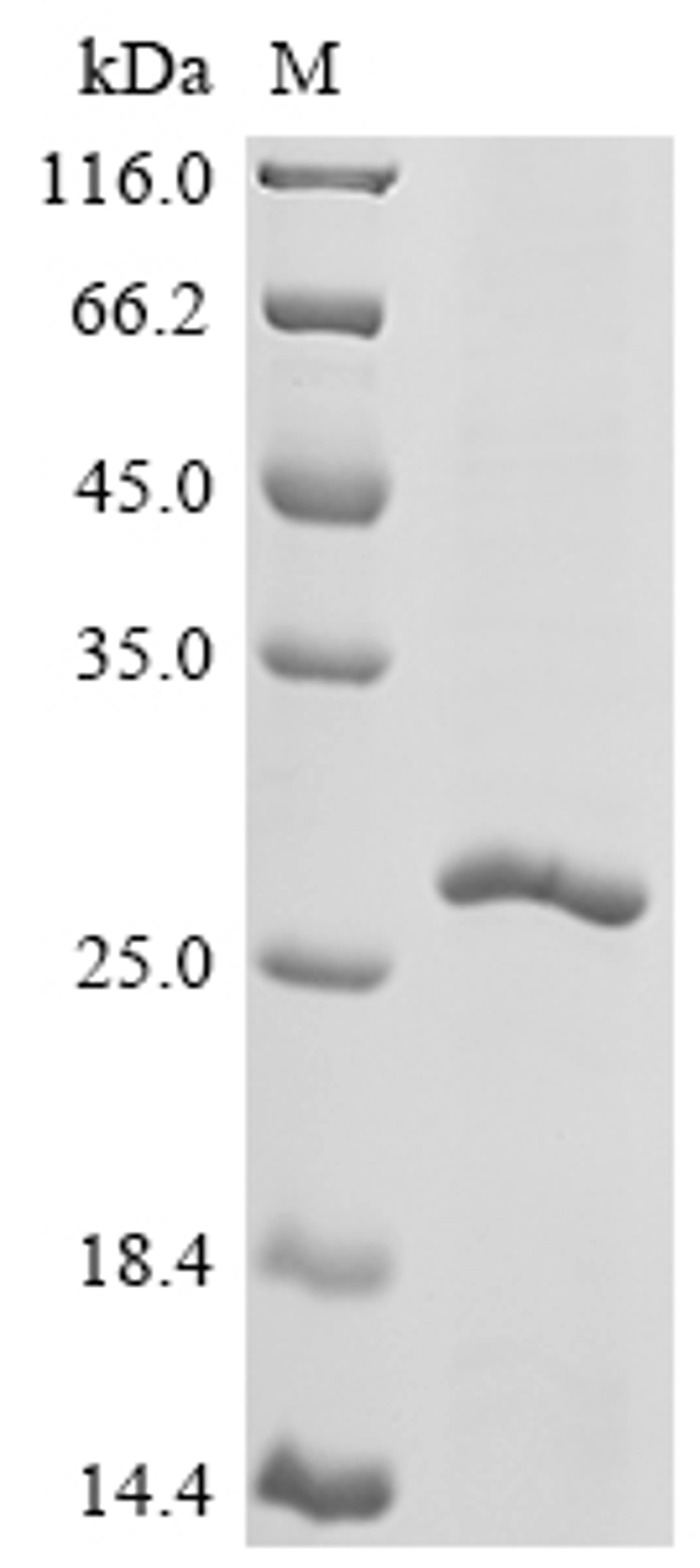 (Tris-Glycine gel) Discontinuous SDS-PAGE (reduced) with 5% enrichment gel and 15% separation gel.