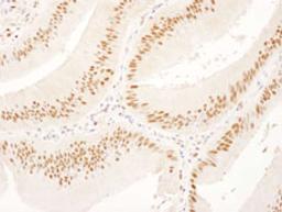 Detection of human USP7 by immunohistochemistry.