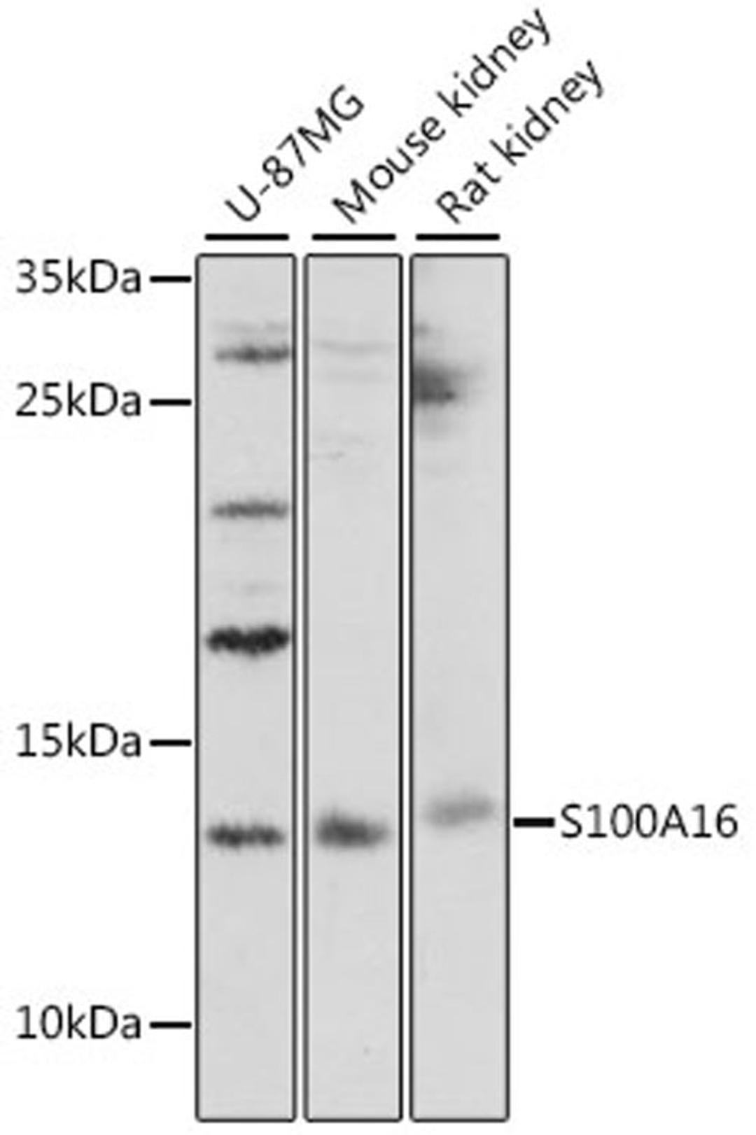 Western blot - S100A16 antibody (A16167)