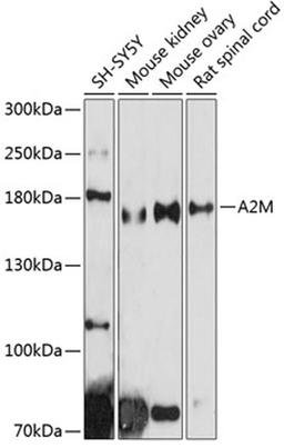 Western blot - A2M antibody (A1573)