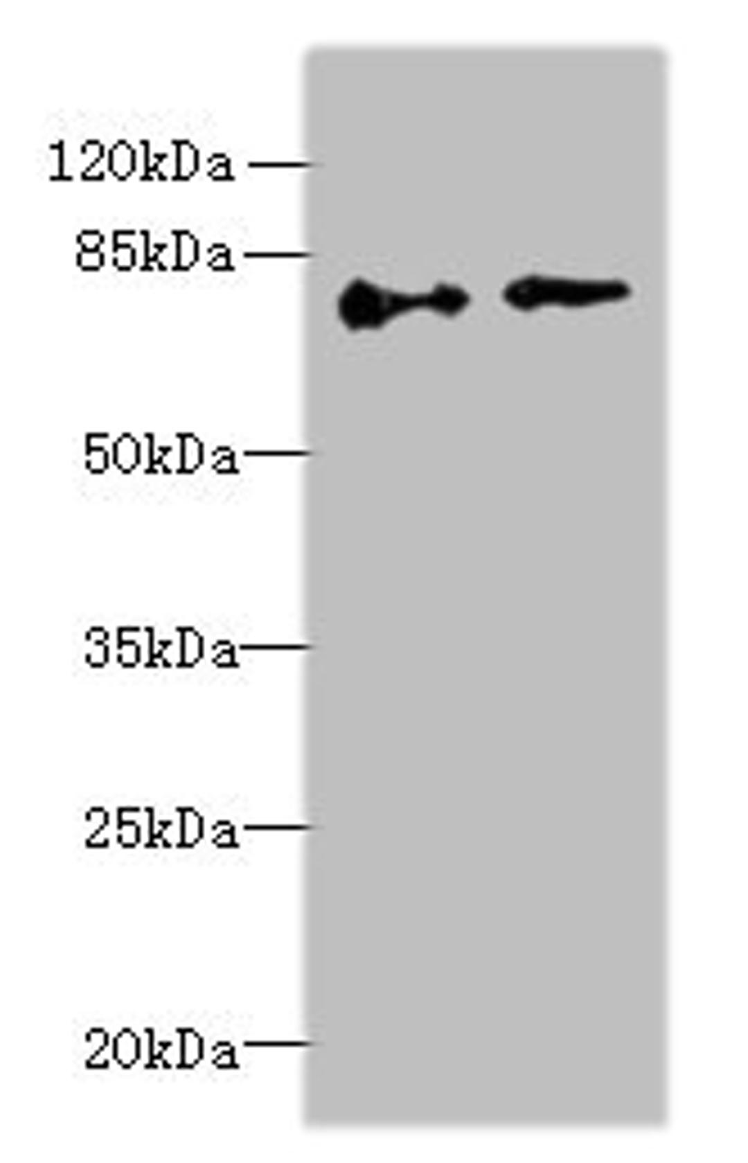 Western blot. All lanes: ECD antibody at 6µg/ml. Lane 1: Hela whole cell lysate. Lane 2: U251 whole cell lysate. Secondary. Goat polyclonal to rabbit IgG at 1/10000 dilution. Predicted band size: 73, 68, 77 kDa. Observed band size: 73 kDa