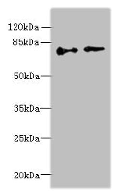 Western blot. All lanes: ECD antibody at 6µg/ml. Lane 1: Hela whole cell lysate. Lane 2: U251 whole cell lysate. Secondary. Goat polyclonal to rabbit IgG at 1/10000 dilution. Predicted band size: 73, 68, 77 kDa. Observed band size: 73 kDa