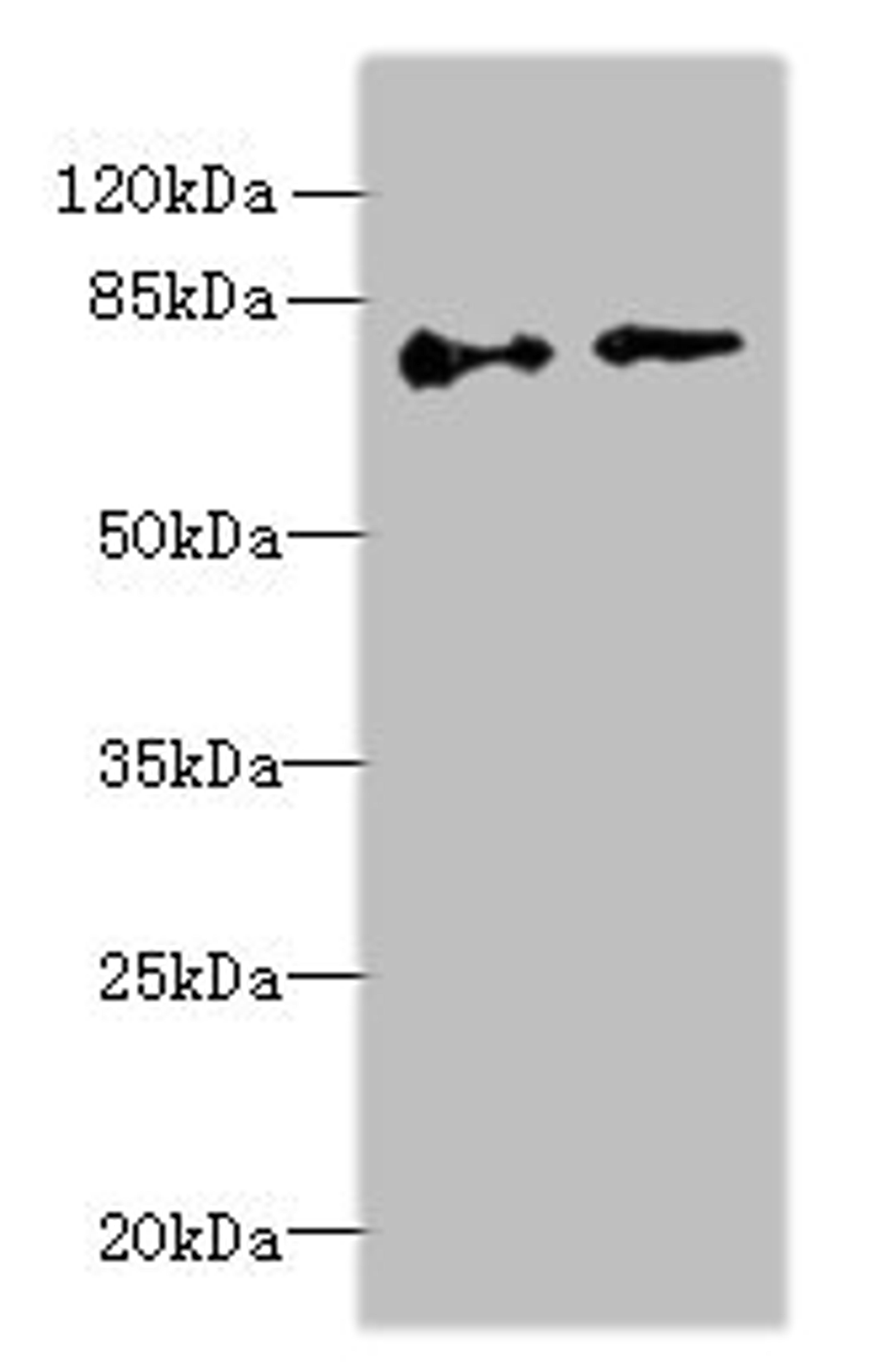 Western blot. All lanes: ECD antibody at 6µg/ml. Lane 1: Hela whole cell lysate. Lane 2: U251 whole cell lysate. Secondary. Goat polyclonal to rabbit IgG at 1/10000 dilution. Predicted band size: 73, 68, 77 kDa. Observed band size: 73 kDa