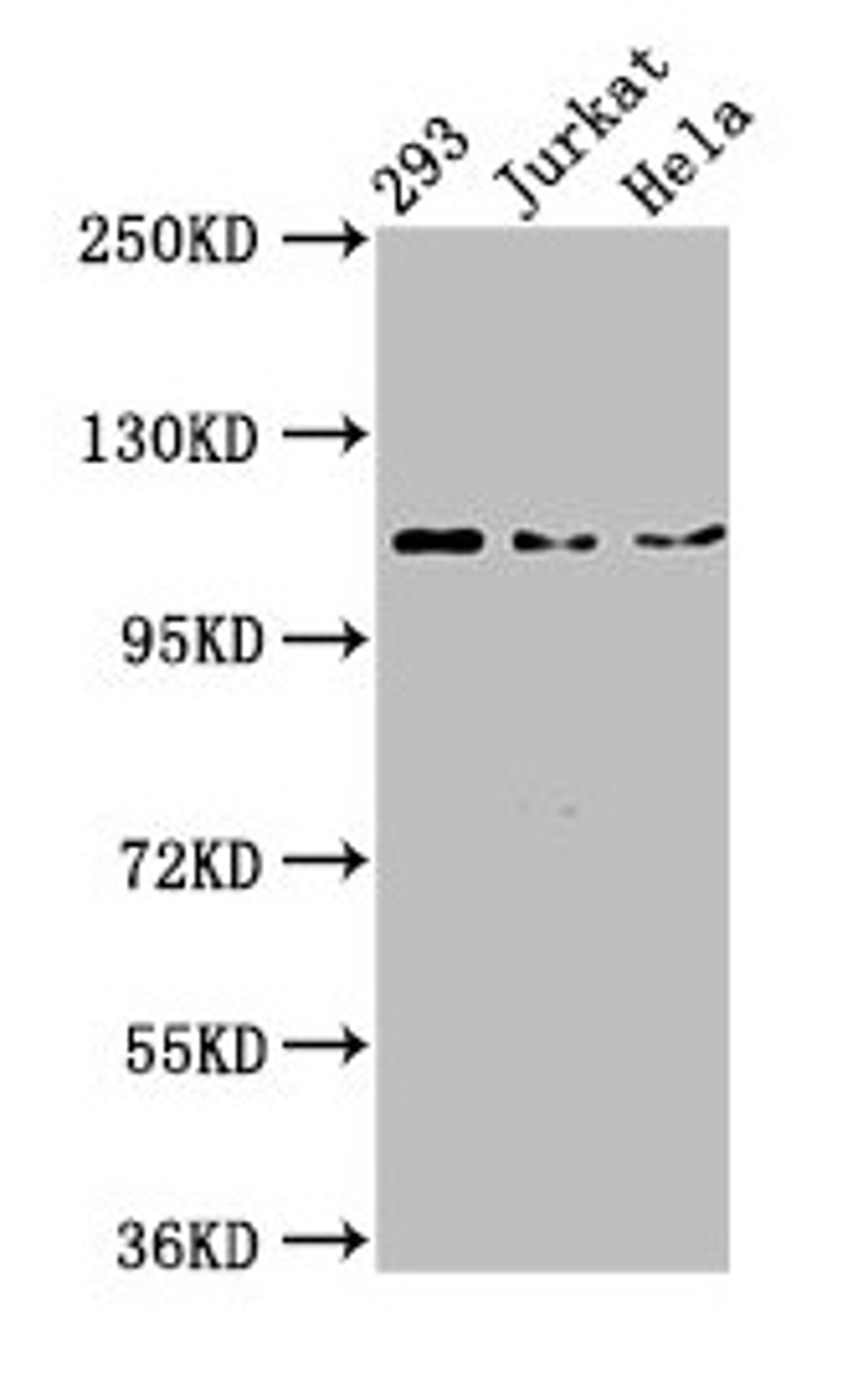 Western Blot. Positive WB detected in: 293 whole cell lysate, Jurkat whole cell lysate, Hela whole cell lysate. All lanes: NEDD4L antibody at 3µg/ml. Secondary. Goat polyclonal to rabbit IgG at 1/50000 dilution. Predicted band size: 112, 105, 101, 99, 111, 110, 97 kDa. Observed band size: 112 kDa