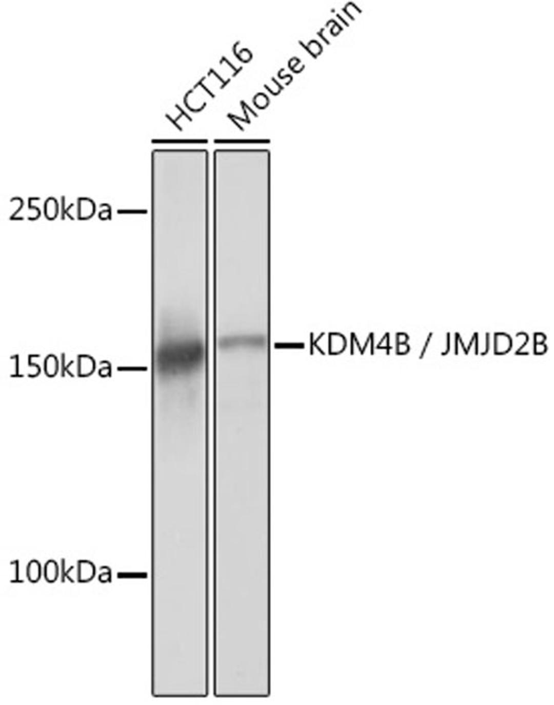 Western blot - KDM4B / JMJD2B Rabbit mAb (A6670)