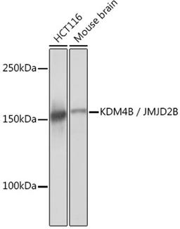 Western blot - KDM4B / JMJD2B Rabbit mAb (A6670)